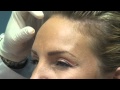 Botox Injection in Fort Lauderdale - Part I