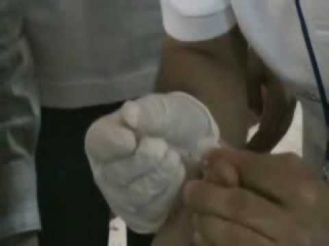 how to collect hsv pcr