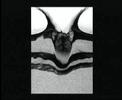 Granular Erruptions Granular Erruptions
