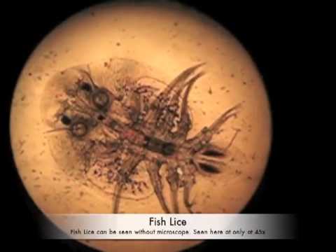 how to treat koi parasites
