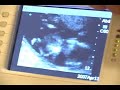 twins15w