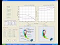 Virtual Musculoskeletal Anatomical Case Study-I