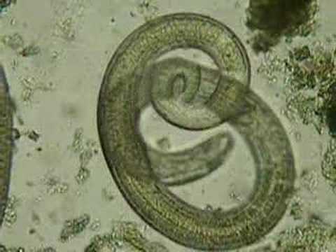 Trichinella spiralis