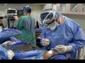 Nose Surgery Turbinate Reduction Closed Rhinoplasty Scarless