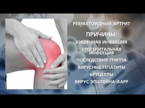 Трансфер фактор при ревматоидном артрит Трансфер фактор при ревматоидном артрит