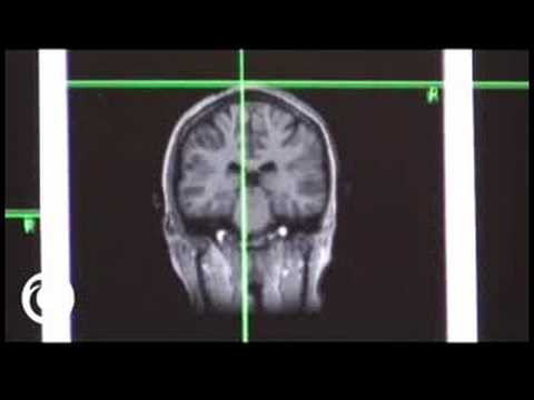 tms - Transcranial Magnetic Stimulation Lets You Deactivate Selected Parts of Your Brain. Transcranial Magnetic Stimulation is a process in which you run an electr...