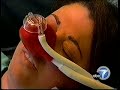 Dentophobia   Fear of The Dentist   Sedation Dentistry