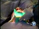 Dentophobia Fear of The Dentist Sedation Dentistry