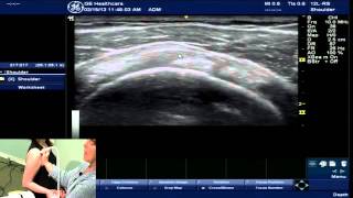 Achieving Expertise in the Rotator Cuff Interval