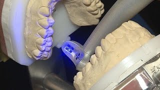 Imagina Diş Teknolojileri fuarında 3D çılgınlığı - hi-tech