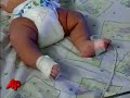 Raw Video: Big Baby Born in Colombia
