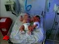Raw Video: Big Baby Born in Colombia