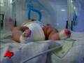 Raw Video: Big Baby Born in Colombia