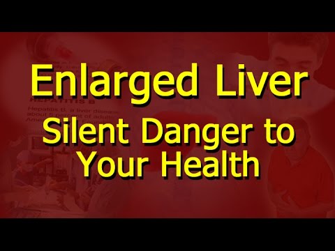 how to cure enlarged liver