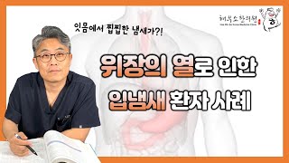 위장의 열로 인한 입냄새