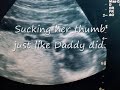 Pregnant & Belly.wmv