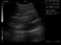 Ultrasound,Baby,20