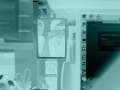 Xray Video #1