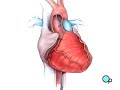 www.preop.com Medical Malpractice and Patient Education Company Patient ED @ 617-379-1582 INFO Then the doctor will make a small cut over the femoral artery in the upper part of the leg. A special needle is then inserted into the artery itself. Then a guide wire is carefully passed through the needle and gently pushed into the artery and upwards towards your chest. A narrow tube, called a catheter is threaded along the wire until it too has reached the coronary artery Next, the doctor uses the catheter to inject a dye into the artery itself. The die shows up on a TV monitor and is used to pinpoint the exact location of the blocked area. Once the restricted area has been identified, a thin wire is inserted into the catheter, and is guided all the way to the blocked area and then slightly beyond. This wire acts as guide for the balloon catheter. It allows your doctor to position the deflated balloon precisely in the middle of the narrowest part of the coronary artery. The balloon is briefly inflated. As it expands, it squeezes the plaque deposits against the wall of the artery. It also stretches the artery wall and enlarges the channel through which blood flows. Your doctor will continue to inflate and deflate the balloon until normal blood flow has been restored. The balloon catheter is then withdrawn and another balloon catheter is inserted. This balloon has the mesh stent tube wrapped around it. Once this tube has been placed in the center of now widened area of the <b>...</b>