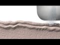 Crystal Clear Microdermabrasion