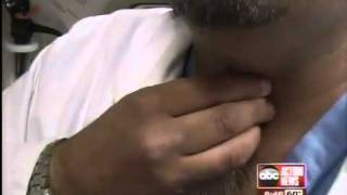 X-Rays and Your Thyroid