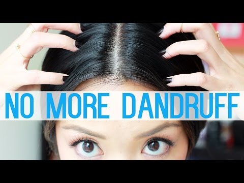 how to reduce dandruff