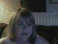 Ehlers-Danlos is a Crappy thing to have