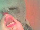 CHIN LIPS