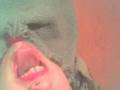 CHIN LIPS