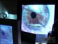 Lasik Eye Surgery