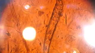 Sarna demodécica (Demodex canis)