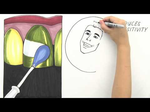 how to whiten bonding