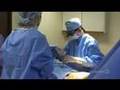 Tummy Tuck - Abdominiplasty - Informational