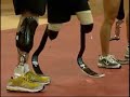 Prosthetics