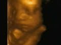 38 weeks