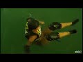 A reality show chick drops about 20 feet off a rope swing and bursts her implant as she hits the water. 
