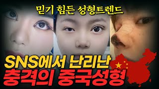 인스타성형외과