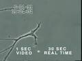 How Mercury Causes Brain Neuron Damage - Uni. of Calgary