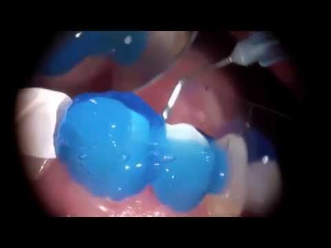 how to obtain iv certification