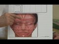 Muscles treated by Botox Explained by Sarasota Dermatologist Muscles treated by Botox Explained by Sarasota Dermatologist