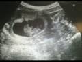 videos de Saraya's Heartbeat
