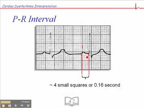 how to measure the p-r interval