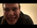 Skrillex - aCapella 
