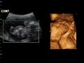 2D 3D SONAR - سونار ثلاثي الابعاد و ثنائي الابعاد