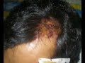 Saharawi students under attack. Part 3