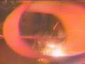 Joust Commercial