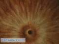 Path of a Red Blood Cell (Britannica.com)