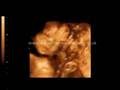 4D Baby Scan #1