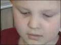 Neuroblastoma patients at Dayton Children's.