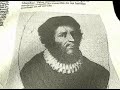 Vesalius Project. Dres. Saenz de Cabezon